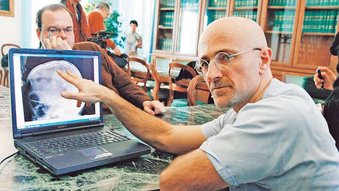 Dünyanın İlk Kafa Nakli Operasyonu Gerçekleştirilecek