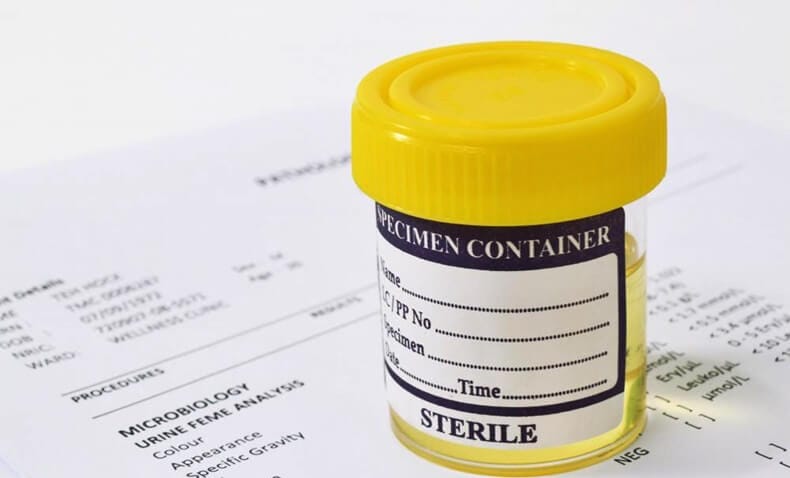 Bilim Adamları Damıtma Yöntemi İle İdrardan İçme Suyu Elde Etti