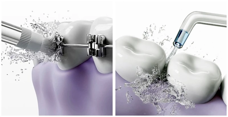xiaomi-mijia-smart-water-flosser-pro.webp