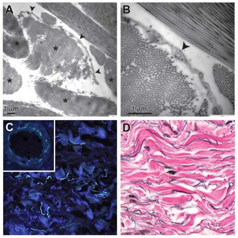 yeni organ interstitium 003 - PC Hocası